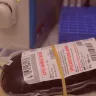 रक्त समूहों की दुनिया! Blood Groups से जुड़े कुछ रोचक और अनजान तथ्य!